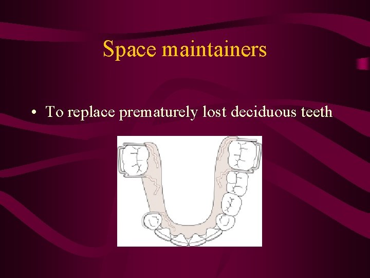 Space maintainers • To replace prematurely lost deciduous teeth 