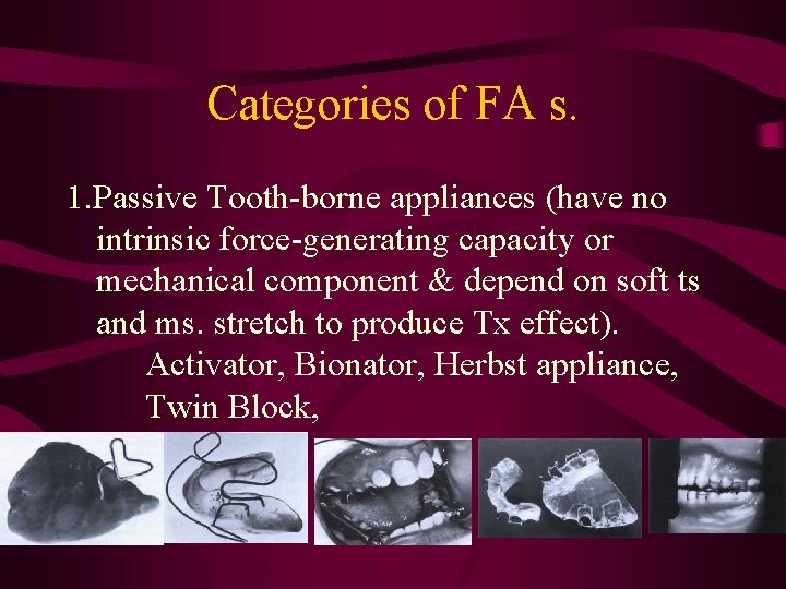 Categories of FA s. 1. Passive Tooth-borne appliances (have no intrinsic force-generating capacity or