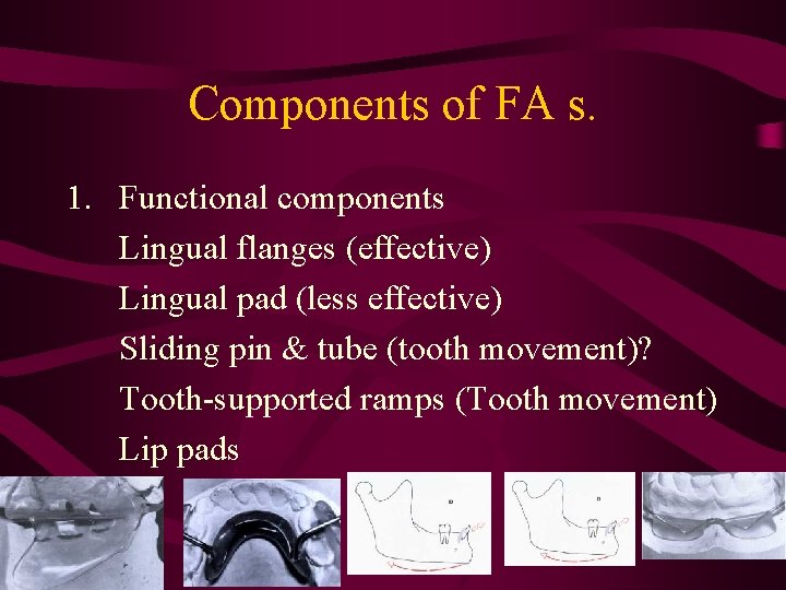 Components of FA s. 1. Functional components Lingual flanges (effective) Lingual pad (less effective)