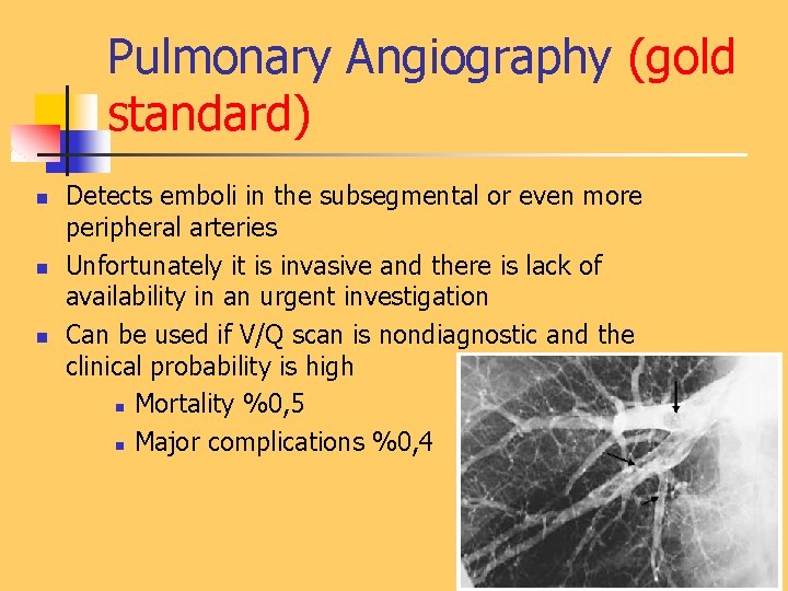 Pulmonary Thromboembolism Prof Sevda zdoan MD Chest Diseases