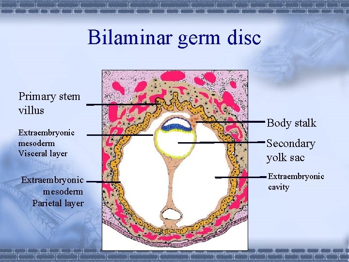 Bilaminar germ disc Primary stem villus Extraembryonic mesoderm Visceral layer Extraembryonic mesoderm Parietal layer