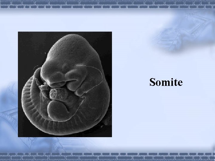 Somite 