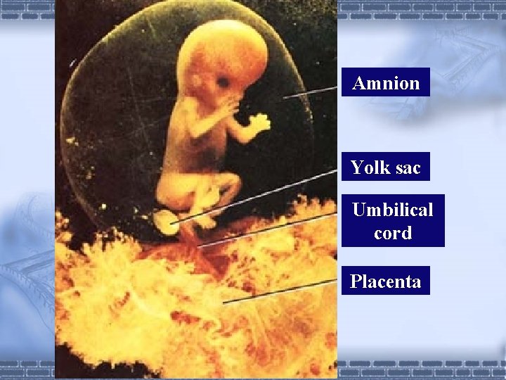 Amnion Yolk sac Umbilical cord Placenta 