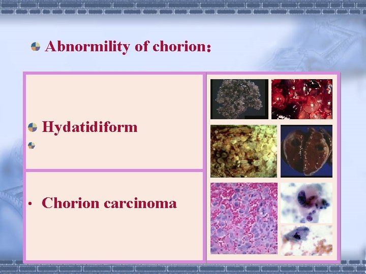 Abnormility of chorion： Hydatidiform Picture • Chorion carcinoma 