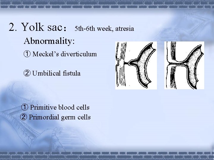 2. Yolk sac： 5 th-6 th week, atresia Abnormality: ① Meckel’s diverticulum ② Umbilical