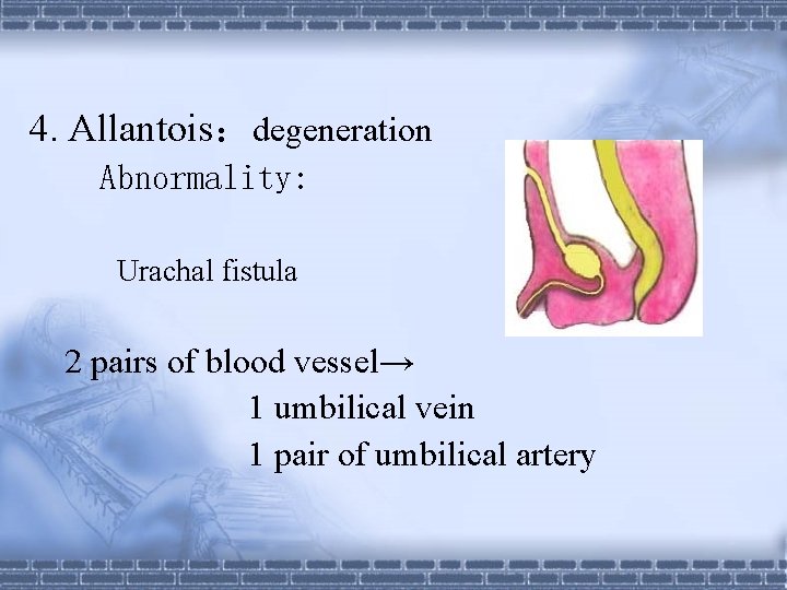 4. Allantois：degeneration Abnormality: Urachal fistula 2 pairs of blood vessel→ 1 umbilical vein 1