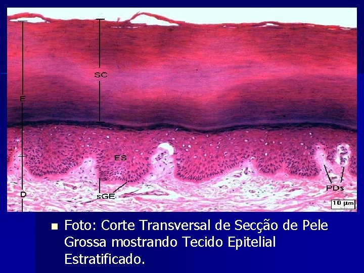 n Foto: Corte Transversal de Secção de Pele Grossa mostrando Tecido Epitelial Estratificado. 