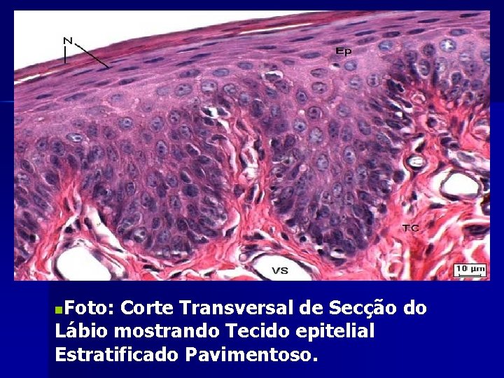 Foto: Corte Transversal de Secção do Lábio mostrando Tecido epitelial Estratificado Pavimentoso. n 