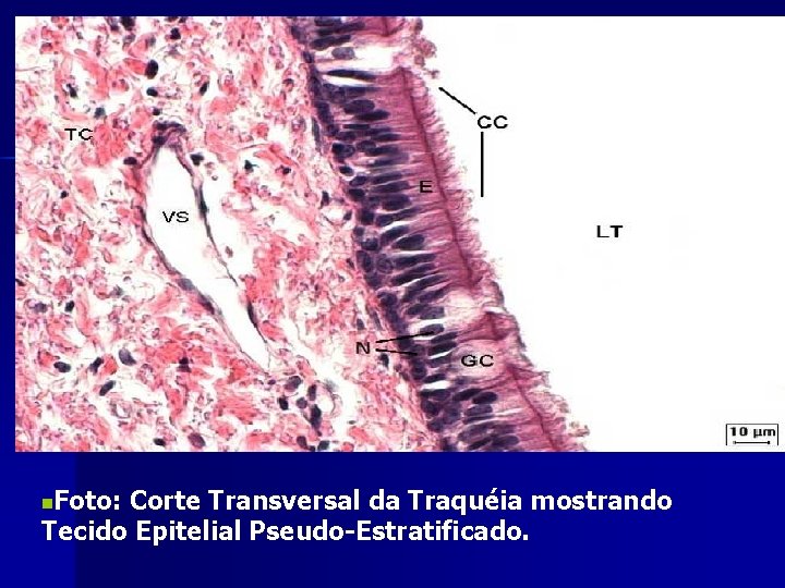 Foto: Corte Transversal da Traquéia mostrando Tecido Epitelial Pseudo-Estratificado. n 