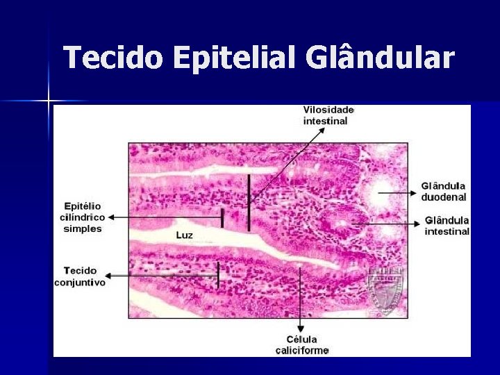 Tecido Epitelial Glândular 