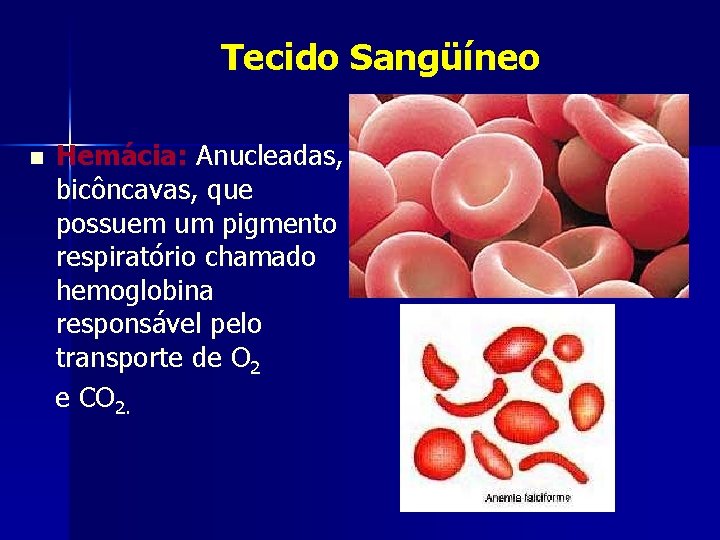 Tecido Sangüíneo n Hemácia: Anucleadas, bicôncavas, que possuem um pigmento respiratório chamado hemoglobina responsável