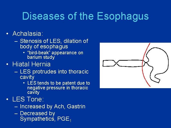 Diseases of the Esophagus • Achalasia: – Stenosis of LES, dilation of body of