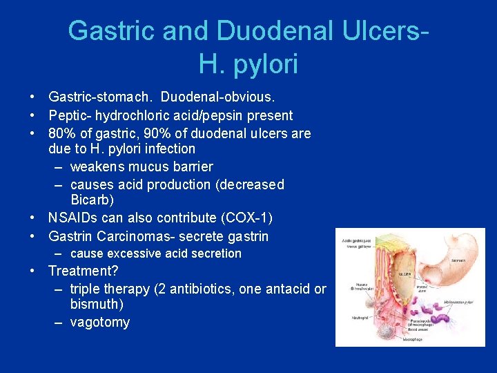 Gastric and Duodenal Ulcers. H. pylori • Gastric-stomach. Duodenal-obvious. • Peptic- hydrochloric acid/pepsin present