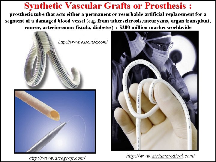 Synthetic Vascular Grafts or Prosthesis : prosthetic tube that acts either a permanent or