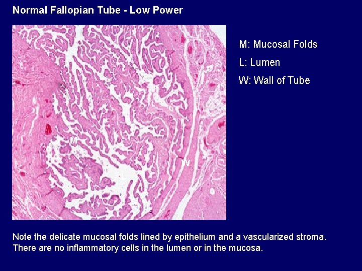 Normal Fallopian Tube - Low Power M: Mucosal Folds L: Lumen W: Wall of