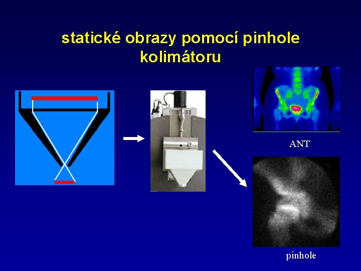 statické obrazy pomocí pinhole kolimátoru ANT pinhole 