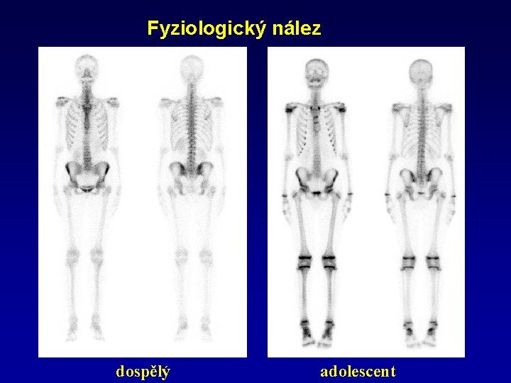 Fyziologický nález dospělý adolescent 