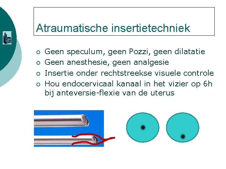 Atraumatische insertietechniek ¡ ¡ Geen speculum, geen Pozzi, geen dilatatie Geen anesthesie, geen analgesie