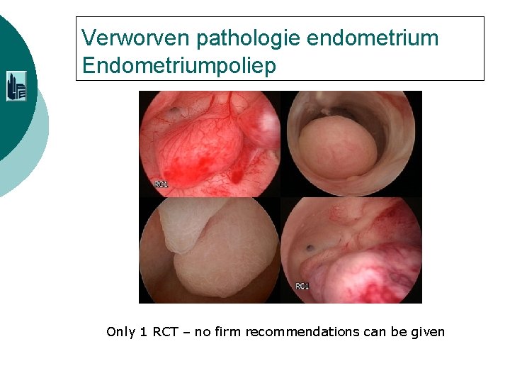 Verworven pathologie endometrium Endometriumpoliep Only 1 RCT – no firm recommendations can be given