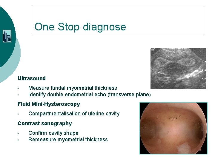 One Stop diagnose Ultrasound • • Measure fundal myometrial thickness Identify double endometrial echo