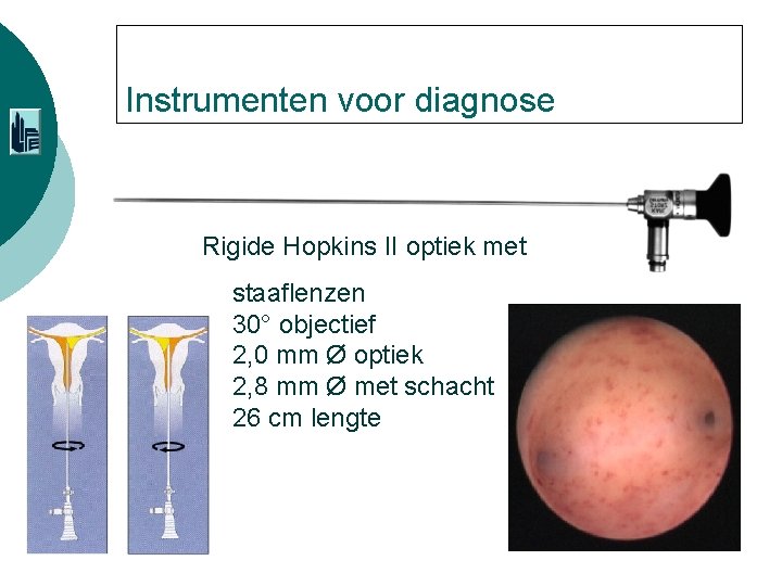 Instrumenten voor diagnose Rigide Hopkins II optiek met staaflenzen 30° objectief 2, 0 mm