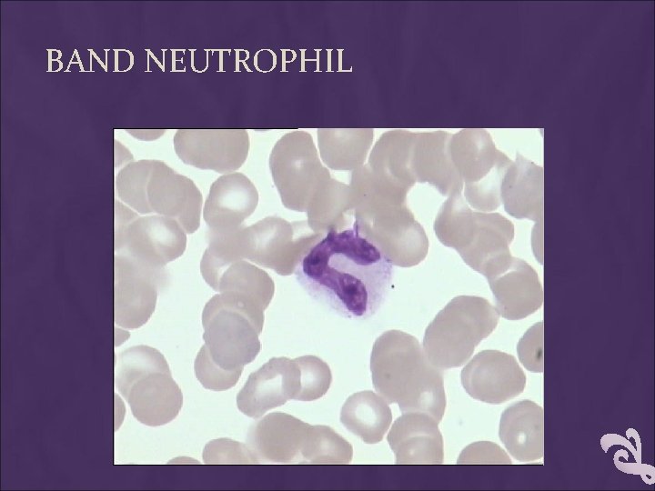 BAND NEUTROPHIL 