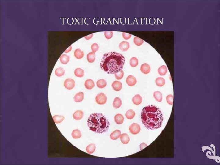 TOXIC GRANULATION 