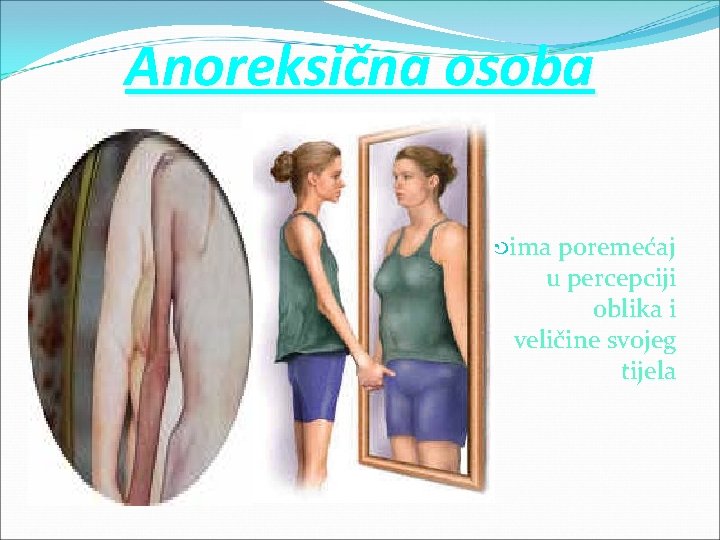 Anoreksična osoba ima poremećaj u percepciji oblika i veličine svojeg tijela 