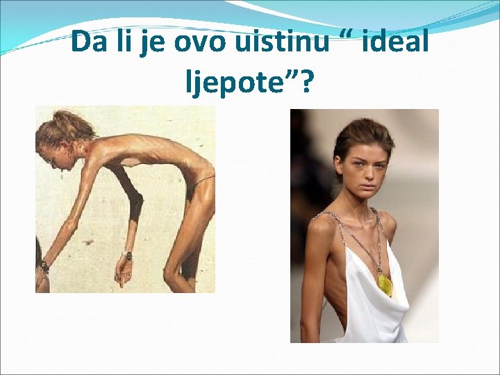 Da li je ovo uistinu “ ideal ljepote”? 