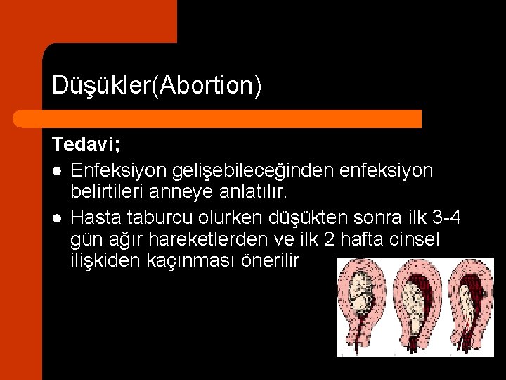 Düşükler(Abortion) Tedavi; l Enfeksiyon gelişebileceğinden enfeksiyon belirtileri anneye anlatılır. l Hasta taburcu olurken düşükten