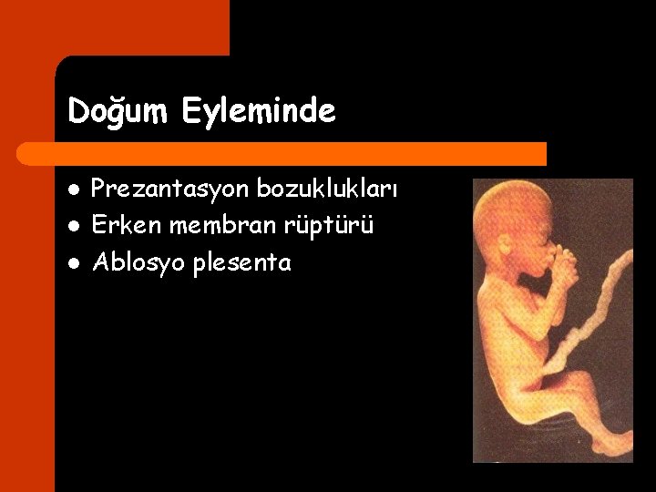 Doğum Eyleminde l l l Prezantasyon bozuklukları Erken membran rüptürü Ablosyo plesenta 