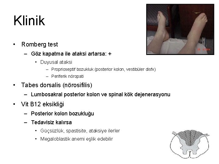 Klinik • Romberg test – Göz kapatma ile ataksi artarsa: + • Duyusal ataksi