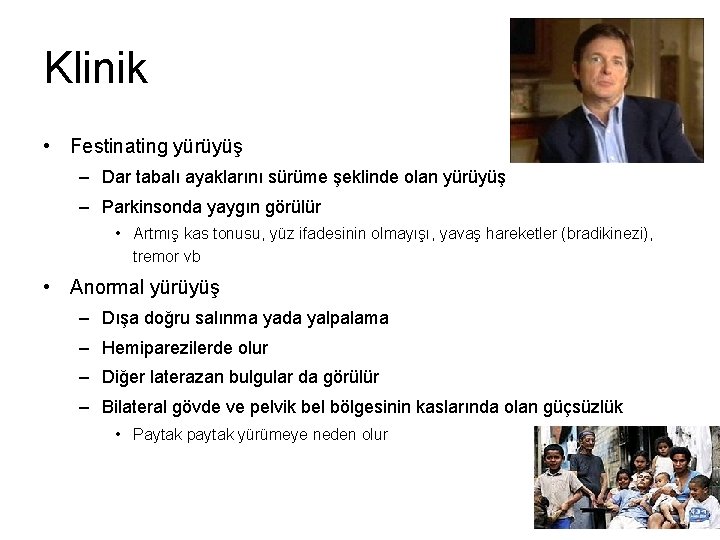 Klinik • Festinating yürüyüş – Dar tabalı ayaklarını sürüme şeklinde olan yürüyüş – Parkinsonda