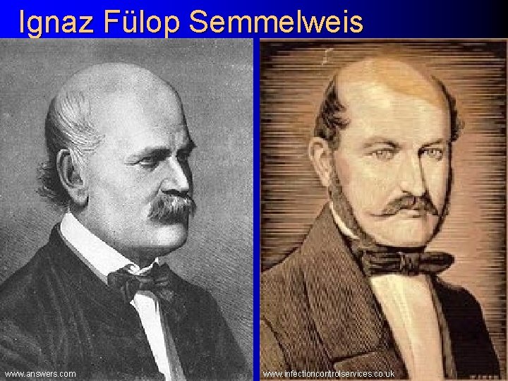 Ignaz Fülop Semmelweis www. answers. com www. infectioncontrolservices. co. uk 