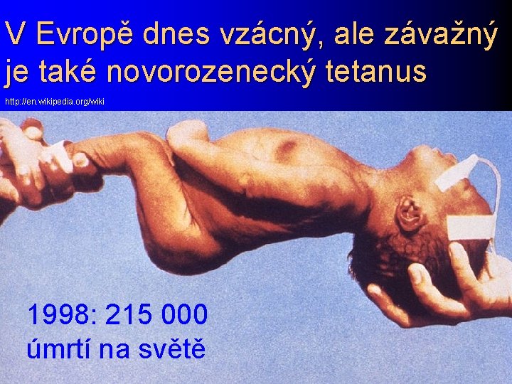 V Evropě dnes vzácný, ale závažný je také novorozenecký tetanus http: //en. wikipedia. org/wiki