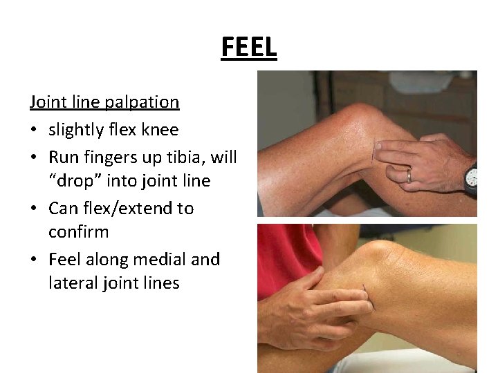 FEEL Joint line palpation • slightly flex knee • Run fingers up tibia, will