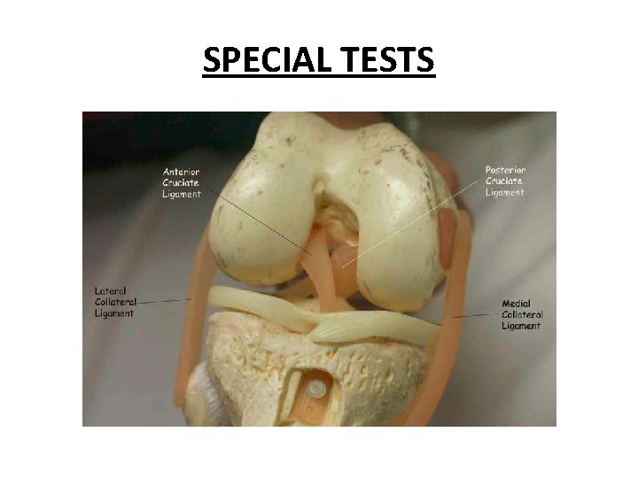 SPECIAL TESTS 