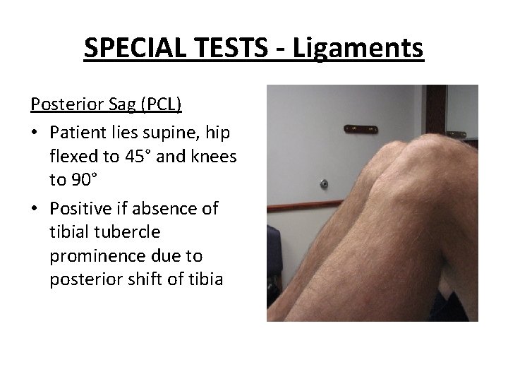 SPECIAL TESTS - Ligaments Posterior Sag (PCL) • Patient lies supine, hip flexed to