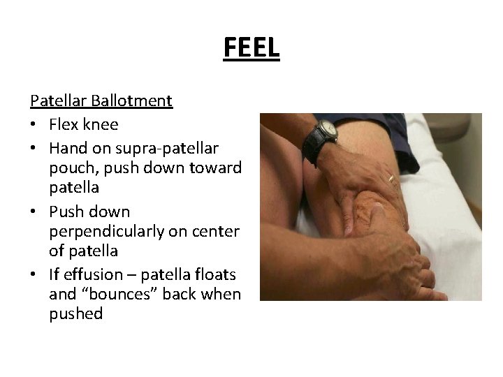 FEEL Patellar Ballotment • Flex knee • Hand on supra-patellar pouch, push down toward