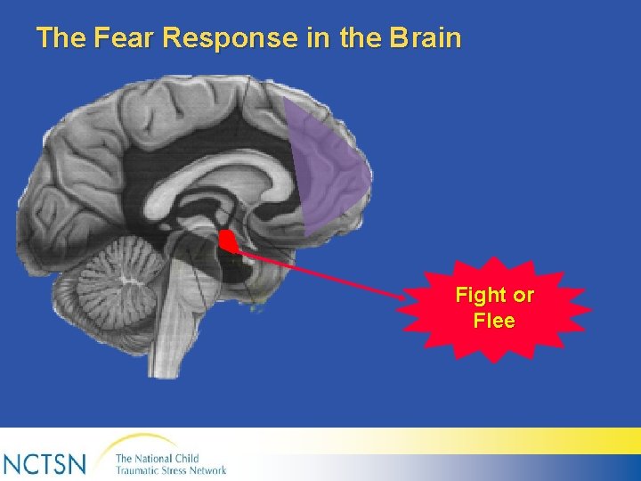 The Fear Response in the Brain Fight or Flee 
