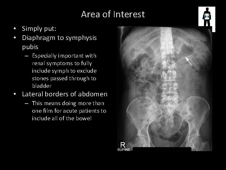 Area of Interest • Simply put: • Diaphragm to symphysis pubis – Especially important