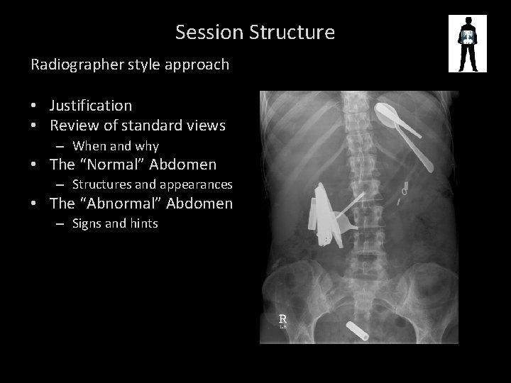Session Structure Radiographer style approach • Justification • Review of standard views – When