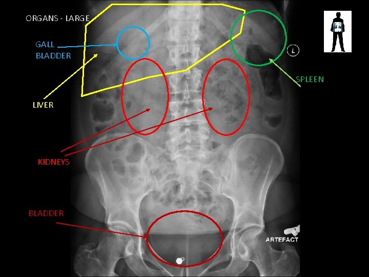 ORGANS - LARGE GALL BLADDER SPLEEN LIVER KIDNEYS BLADDER 