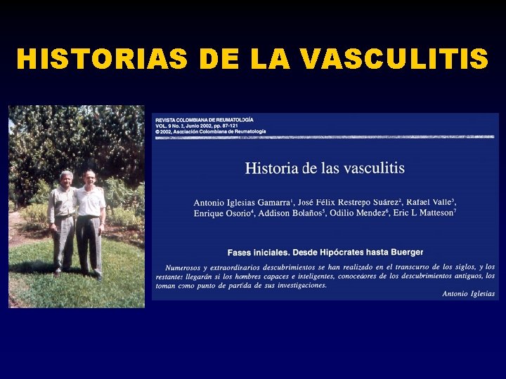 HISTORIAS DE LA VASCULITIS 