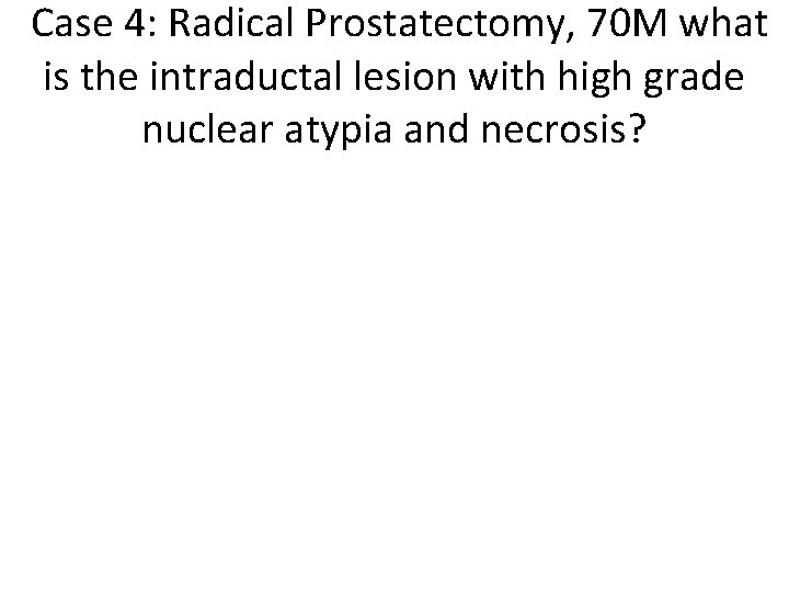  Case 4: Radical Prostatectomy, 70 M what is the intraductal lesion with high