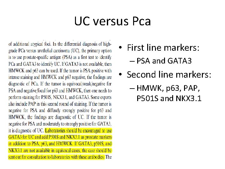 UC versus Pca • First line markers: – PSA and GATA 3 • Second