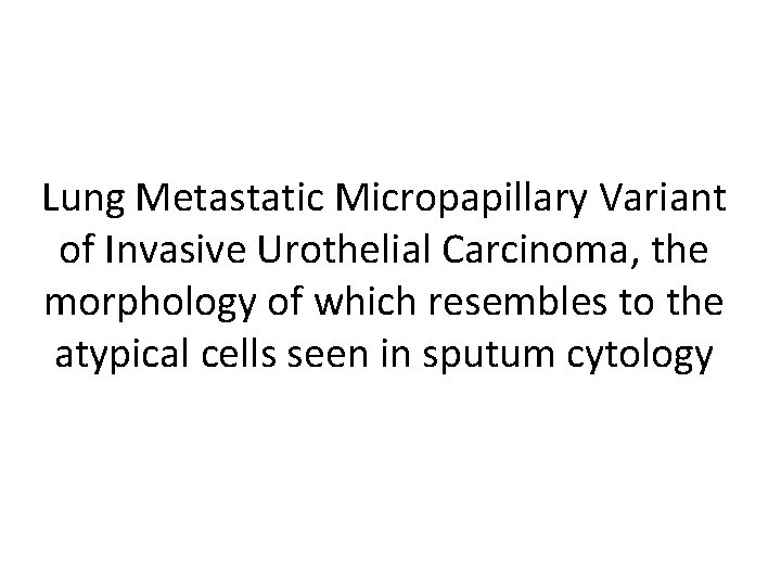Lung Metastatic Micropapillary Variant of Invasive Urothelial Carcinoma, the morphology of which resembles to