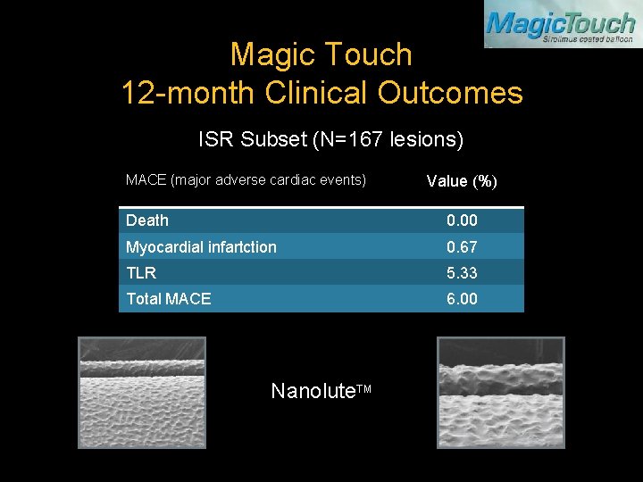 Magic Touch 12 -month Clinical Outcomes ISR Subset (N=167 lesions) MACE (major adverse cardiac