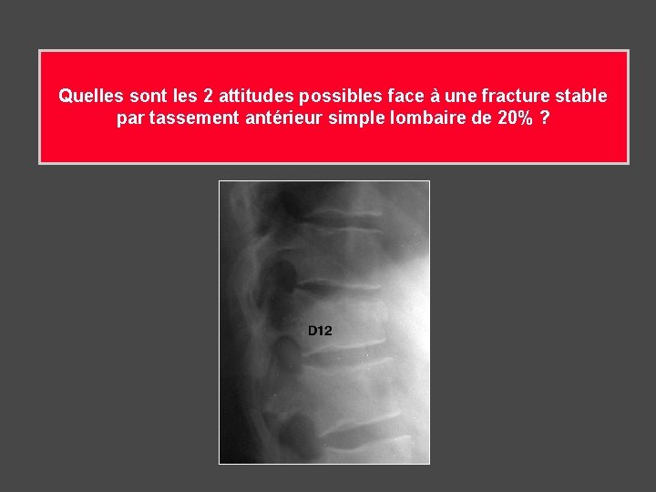 Quelles sont les 2 attitudes possibles face à une fracture stable par tassement antérieur