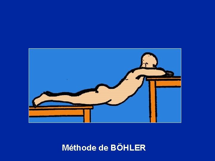 Méthode de BÖHLER 